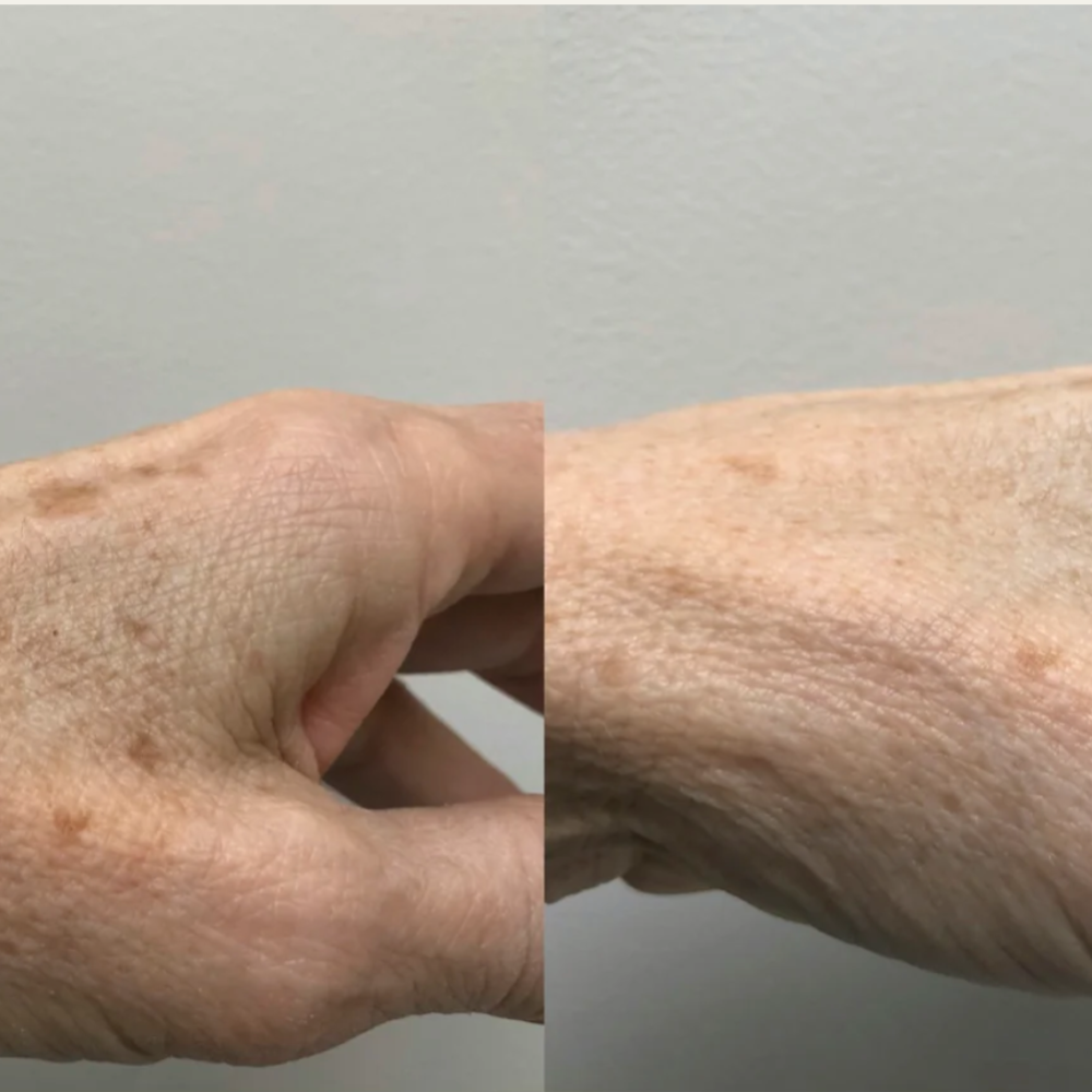 Renewing Hand Serum at Home Smith